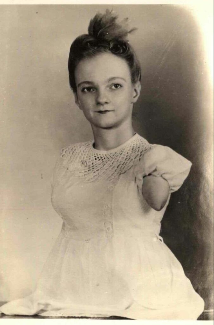 La conmovedora historia de Frida la media niña, una de las últimas estrellas de la era de los “circos freaks” La conmovedora historia de Frida la media niña, una de las últimas estrellas de la era de los “circos freaks”