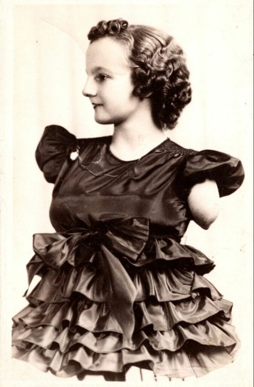 La conmovedora historia de Frida la media niña, una de las últimas estrellas de la era de los “circos freaks” La conmovedora historia de Frida la media niña, una de las últimas estrellas de la era de los “circos freaks”