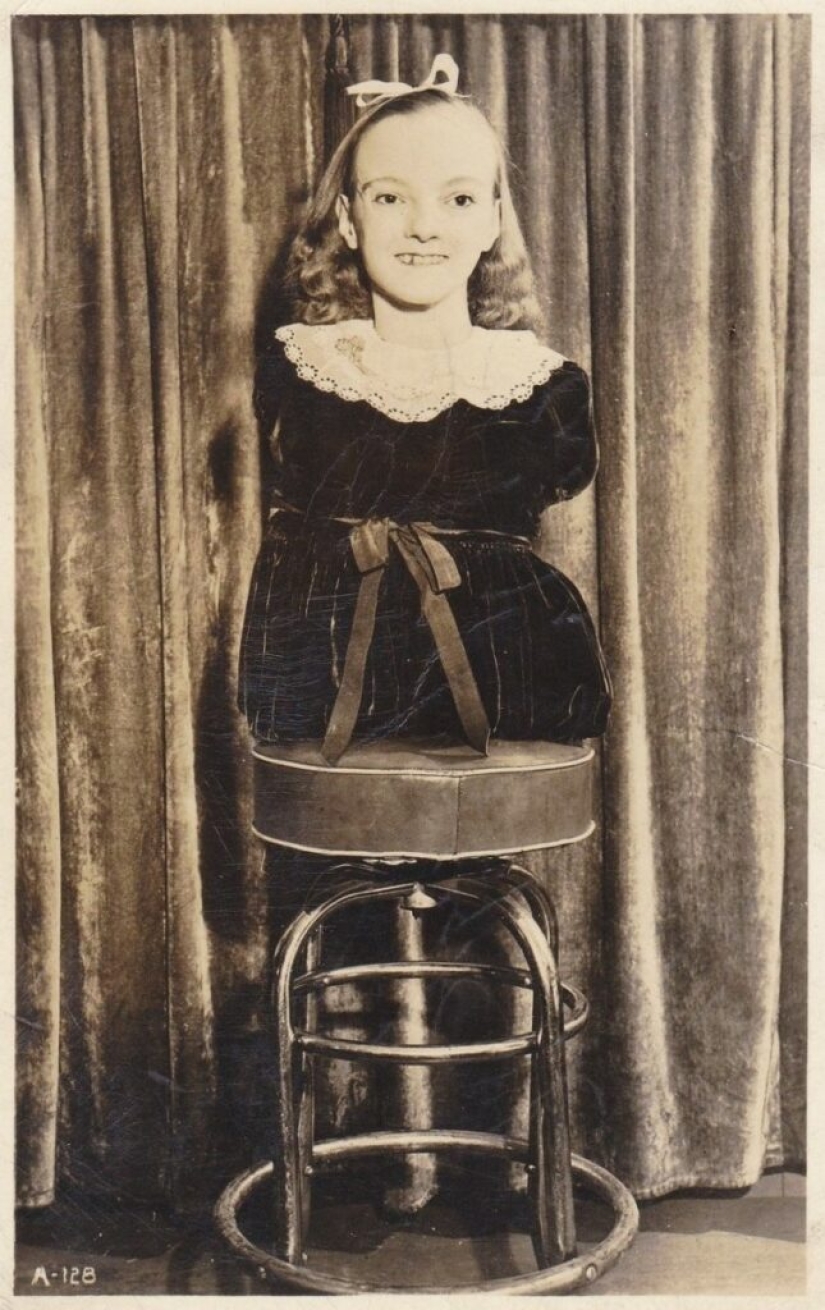 La conmovedora historia de Frida la media niña, una de las últimas estrellas de la era de los “circos freaks” La conmovedora historia de Frida la media niña, una de las últimas estrellas de la era de los “circos freaks”