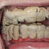 La gente comparte imágenes que hacen que otros “sufran”, y la situación empeora cuanto más las miras