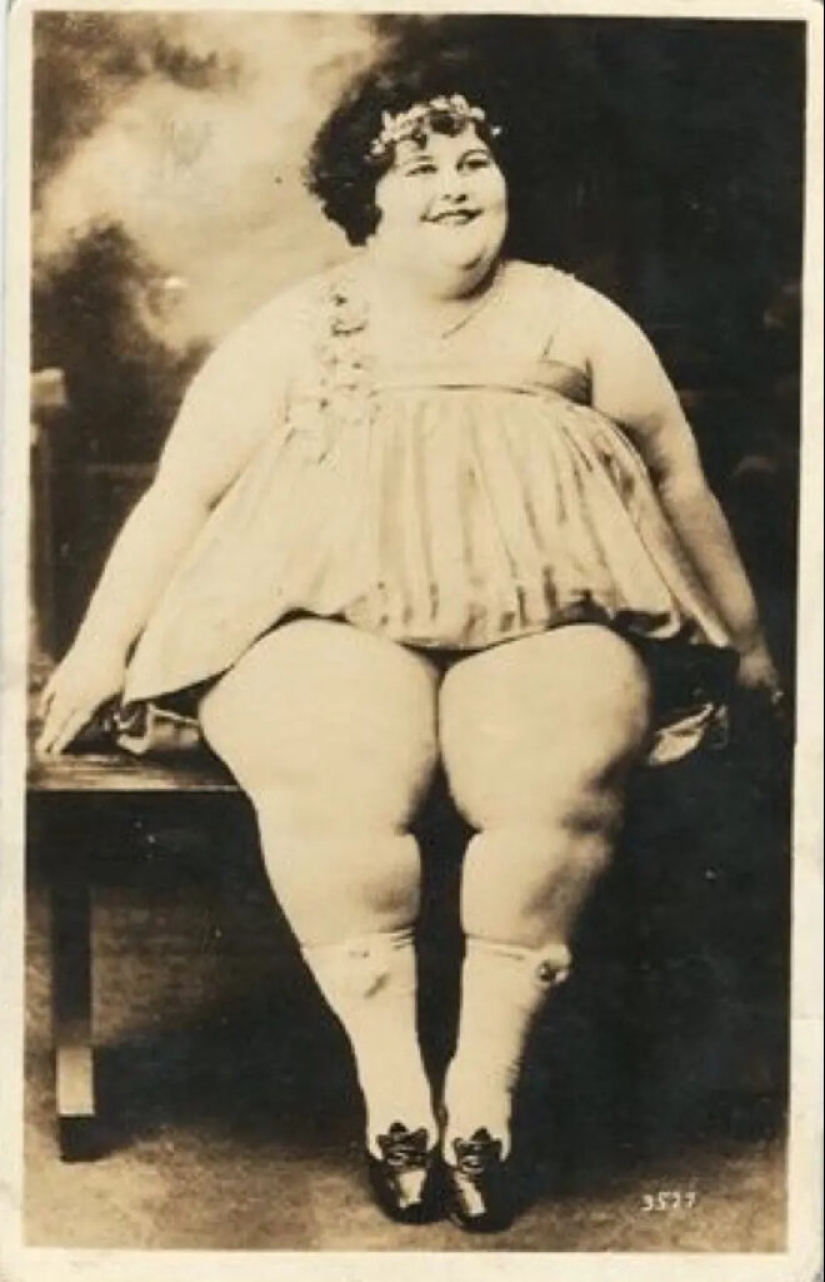La historia de la tenaz artista de circo Dolly Dimples, que se hizo famosa por ganar peso primero y luego perderlo.