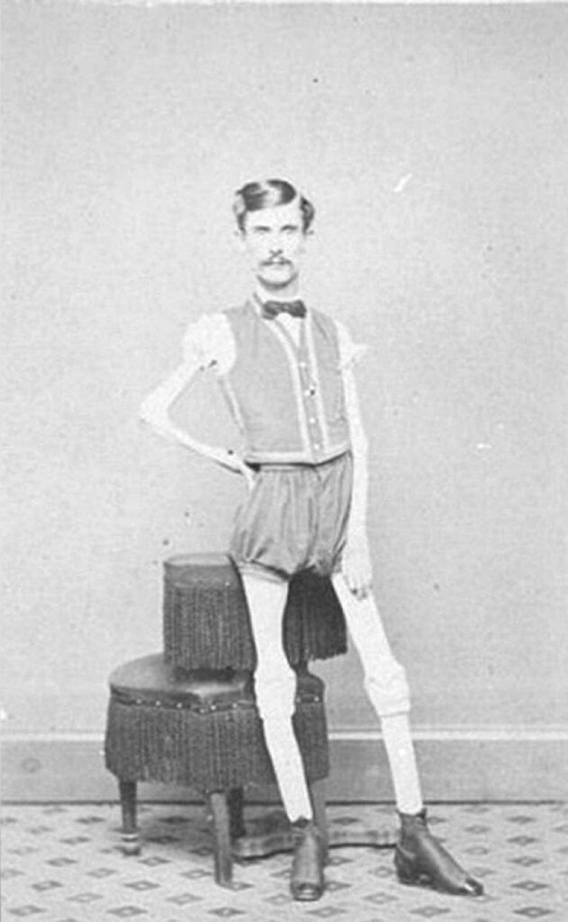 La trágica historia del "esqueleto viviente" Isaac Sprague La trágica historia del "esqueleto viviente" Isaac Sprague