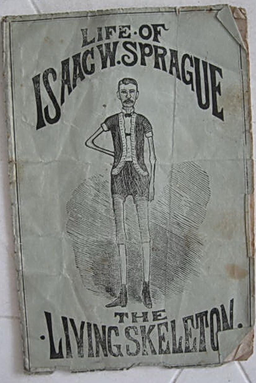 La trágica historia del "esqueleto viviente" Isaac Sprague La trágica historia del "esqueleto viviente" Isaac Sprague