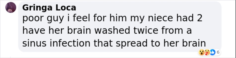 Man Who Underwent Skull Removal Surgeries To “Wash” His Brain Gets Denied Disability Benefits Man Who Underwent Skull Removal Surgeries To “Wash” His Brain Gets Denied Disability Benefits
