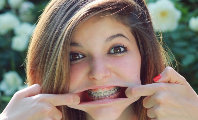 Monobrow, braces and 8 more appearance flaws that are considered attractive by other peoples Monobrow, braces and 8 more appearance flaws that are considered attractive by other peoples