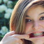 Monobrow, braces and 8 more appearance flaws that are considered attractive by other peoples Monobrow, braces and 8 more appearance flaws that are considered attractive by other peoples