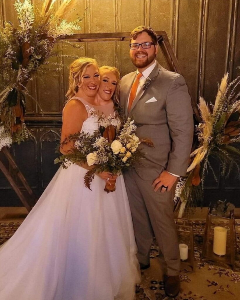 One of the sisters of the Siamese twins Hensel got married One of the sisters of the Siamese twins Hensel got married