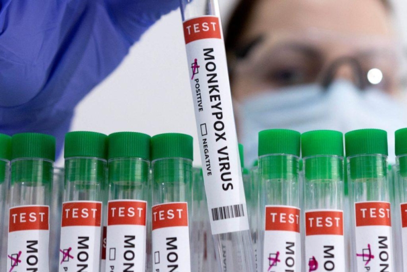 Por qué los cerdos se utilizan como donantes de órganos para humanos y no para monos