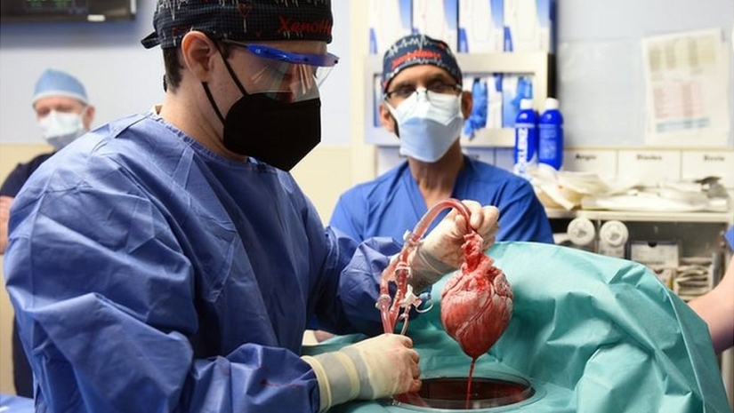 Por qué los cerdos se utilizan como donantes de órganos para humanos y no para monos