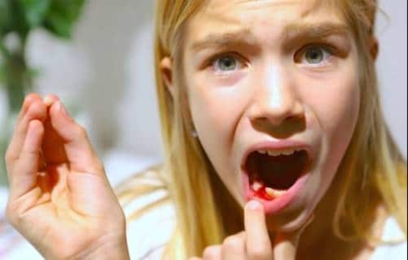 ¿Por qué sueñas con perder dientes y vale la pena tener miedo de tal sueño