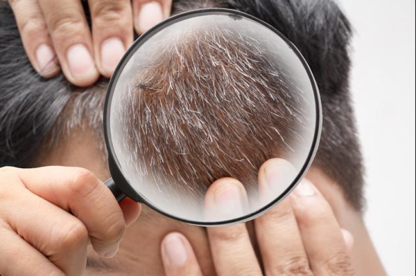 ¿Puede una persona volverse gris instantáneamente por el miedo?