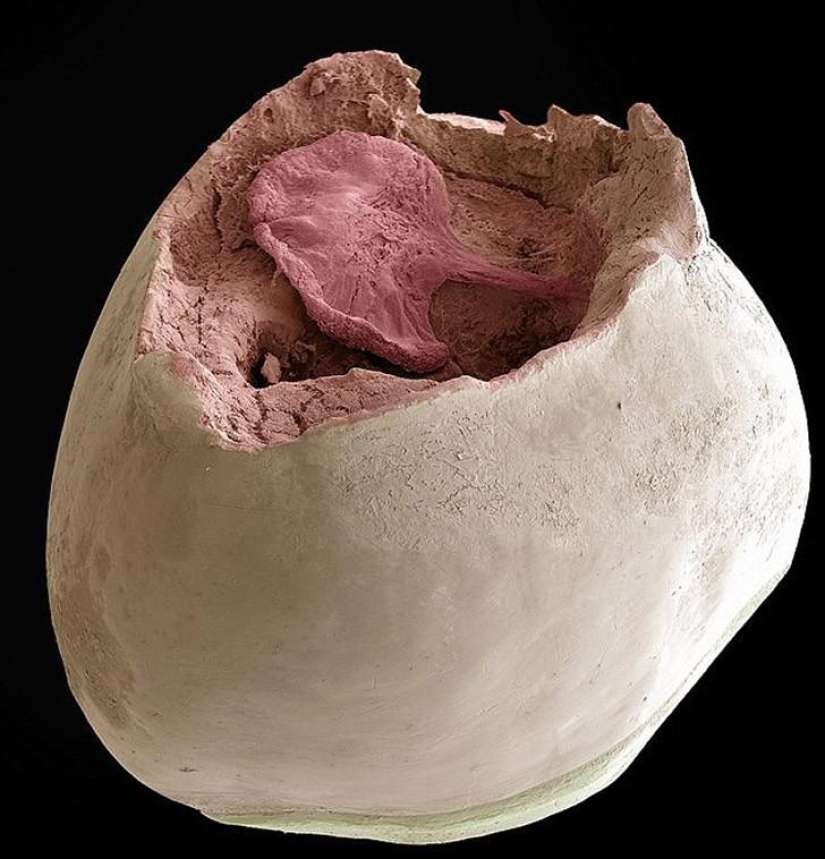 ¿Qué hay en tu boca, primer plano?