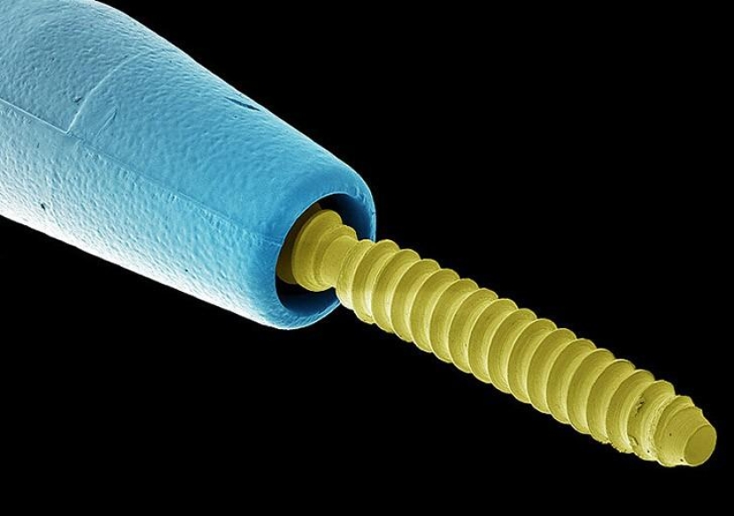 ¿Qué hay en tu boca, primer plano?