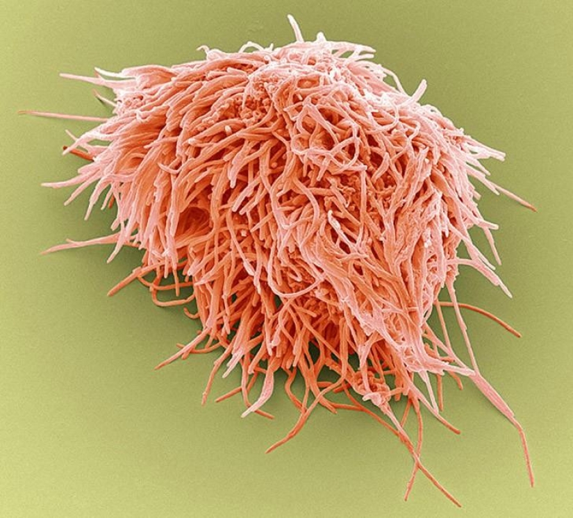 ¿Qué hay en tu boca, primer plano?