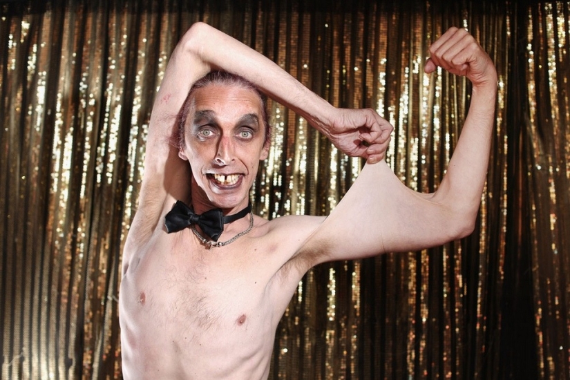 Rubber Face: how Harry Turner, the man with the most elastic skin in the world, lives Rubber Face: how Harry Turner, the man with the most elastic skin in the world, lives