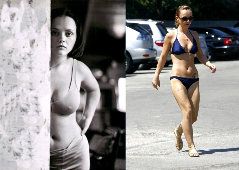 See above: Stars who have had breast reduction surgery See above: Stars who have had breast reduction surgery