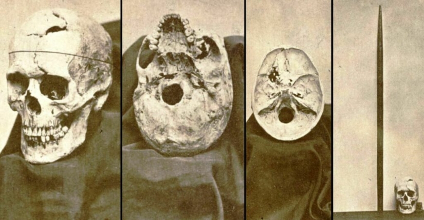The Amazing story of Josephine Myrtle Corbin, a four—legged woman from Texas The Amazing story of Josephine Myrtle Corbin, a four—legged woman from Texas