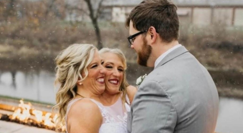 Una de las hermanas de los gemelos siameses Hensel se casó Una de las hermanas de los gemelos siameses Hensel se casó