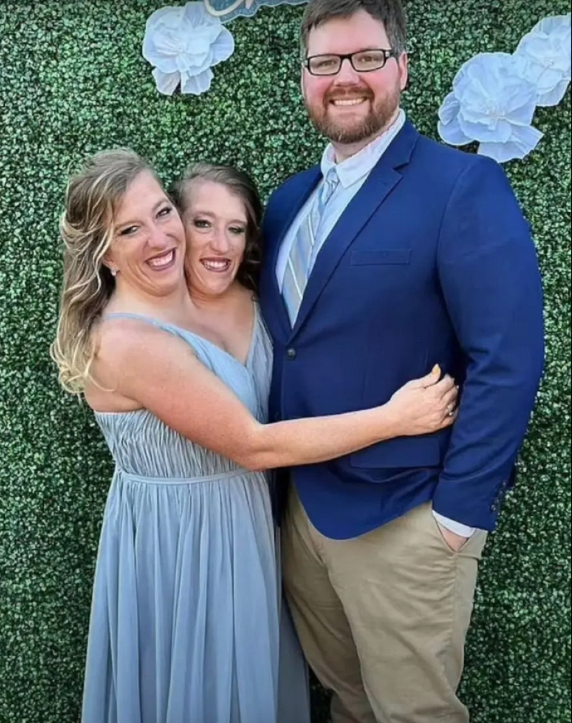 Una de las hermanas de los gemelos siameses Hensel se casó Una de las hermanas de los gemelos siameses Hensel se casó