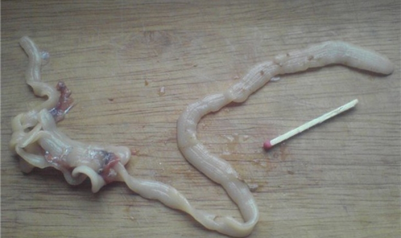 10 de los parásitos más peligrosos que pueden vivir en el cuerpo humano 10 de los parásitos más peligrosos que pueden vivir en el cuerpo humano