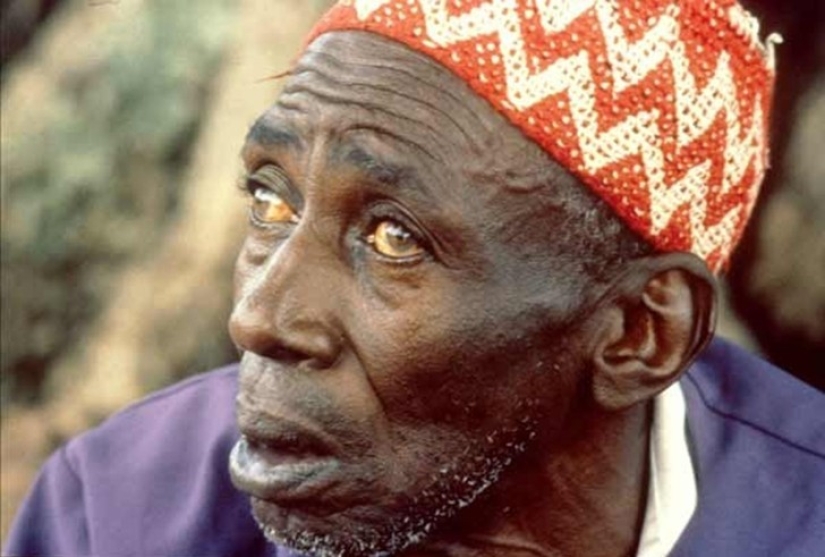 10 de los parásitos más peligrosos que pueden vivir en el cuerpo humano 10 de los parásitos más peligrosos que pueden vivir en el cuerpo humano