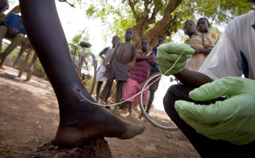 10 de los parásitos más peligrosos que pueden vivir en el cuerpo humano 10 de los parásitos más peligrosos que pueden vivir en el cuerpo humano