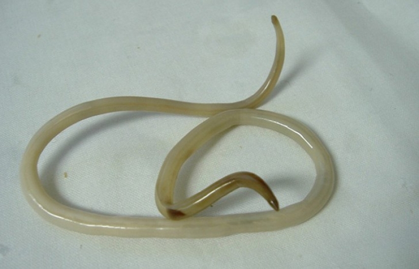 10 de los parásitos más peligrosos que pueden vivir en el cuerpo humano 10 de los parásitos más peligrosos que pueden vivir en el cuerpo humano