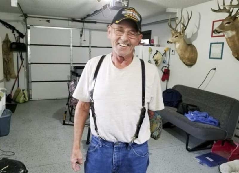 10 extreme situations in which a limb had to be amputated independently in order to survive