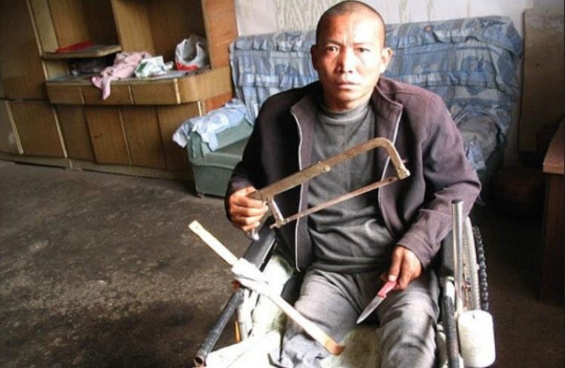 10 extreme situations in which a limb had to be amputated independently in order to survive