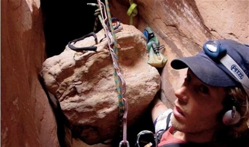 10 situaciones extremas en las que una extremidad tuvo que ser amputada independientemente para sobrevivir 10 situaciones extremas en las que una extremidad tuvo que ser amputada independientemente para sobrevivir