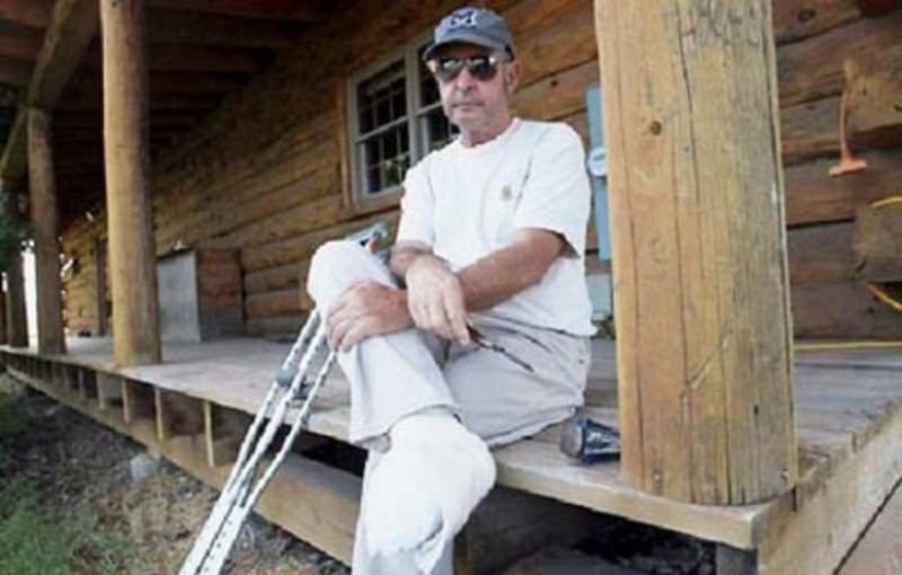 10 situaciones extremas en las que una extremidad tuvo que ser amputada independientemente para sobrevivir 10 situaciones extremas en las que una extremidad tuvo que ser amputada independientemente para sobrevivir