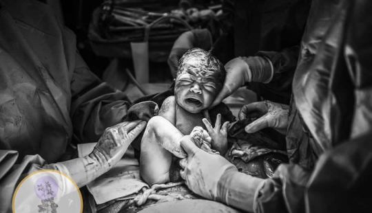 14 Heart-Touching Winning Photos from the 15th Annual Birth Photography Competition 14 Heart-Touching Winning Photos from the 15th Annual Birth Photography Competition