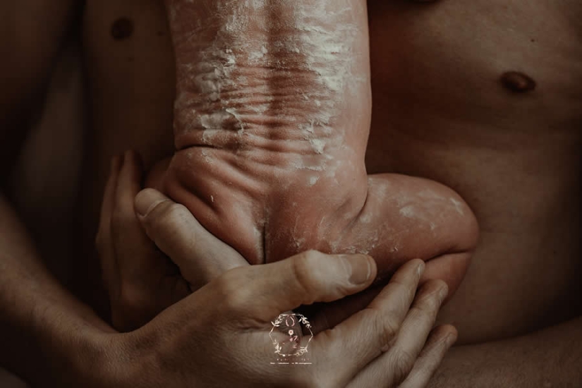 14 Heart-Touching Winning Photos from the 15th Annual Birth Photography Competition