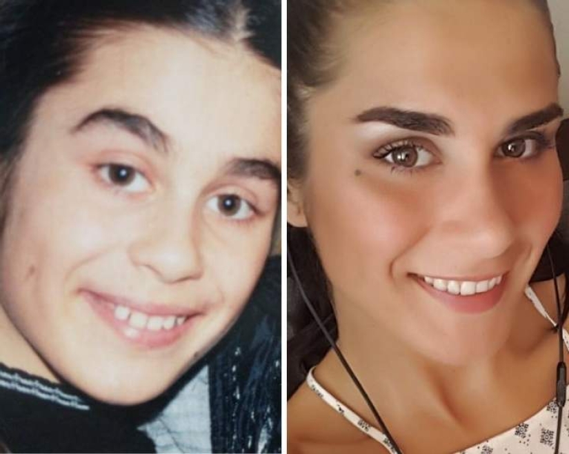 15 ejemplos de cómo las personas son increíblemente cambiado con la edad 15 ejemplos de cómo las personas son increíblemente cambiado con la edad