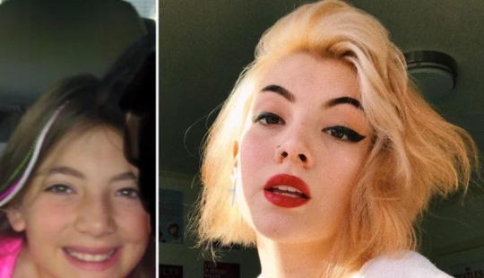 15 ejemplos de cómo los "patitos feos", se convirtió en "hermosos cisnes"