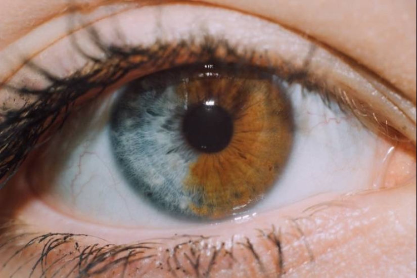 15 people and animals, who won the genetic lottery