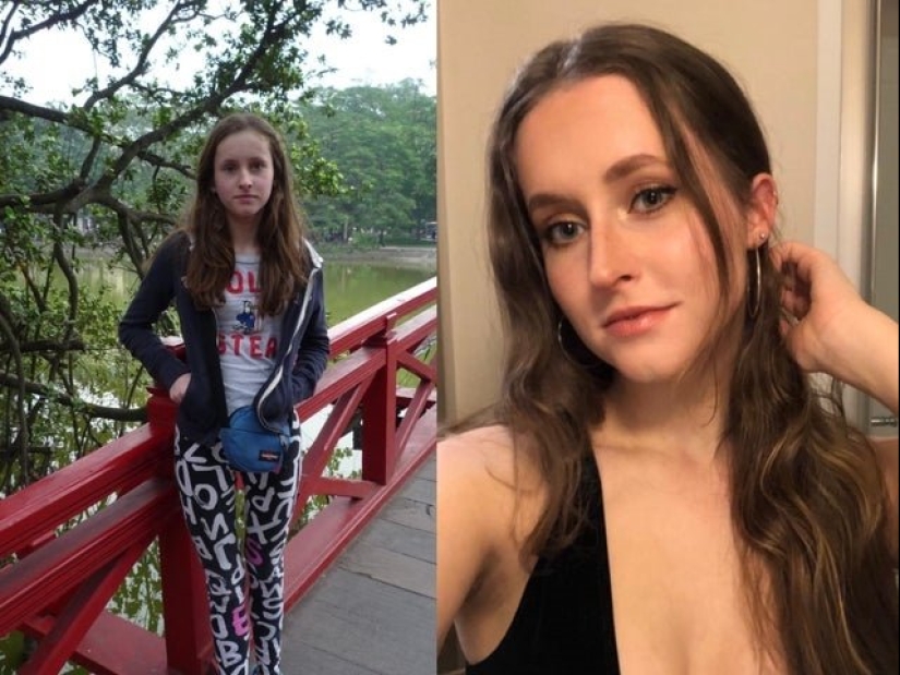 16 amazing transformations of people: in adolescence and now