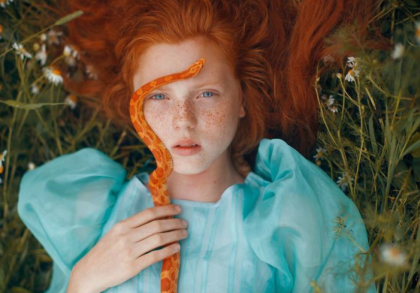 16 Mesmerizing Photos of People with Freckles