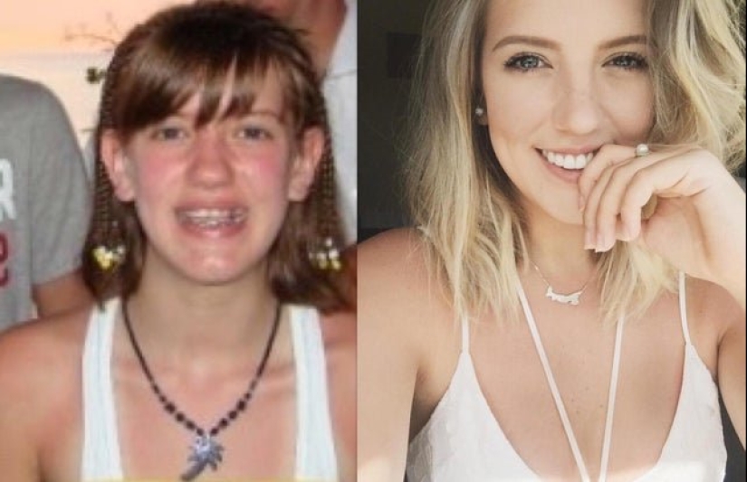 16 transformaciones sorprendentes de las personas: en la adolescencia y ahora