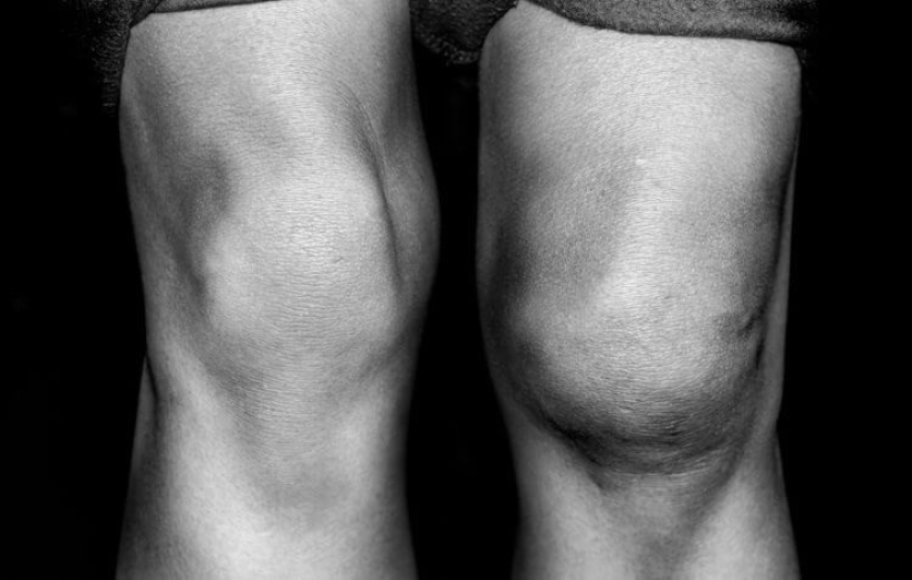 20 human body parts that are an example of bad design