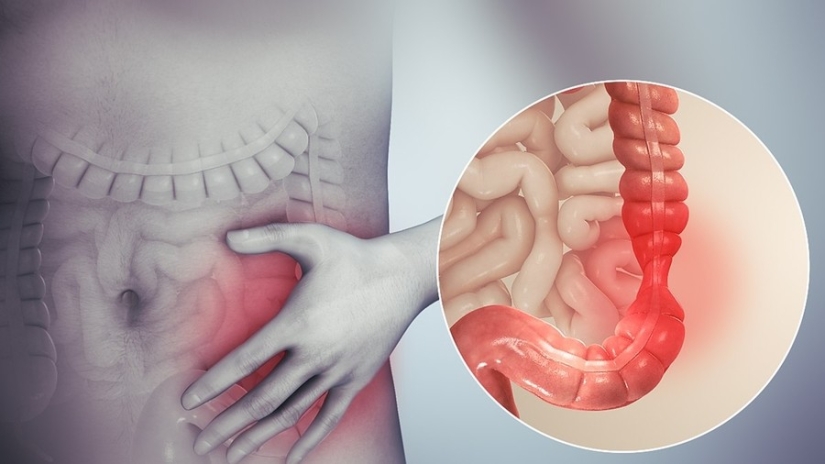 20 human body parts that are an example of bad design
