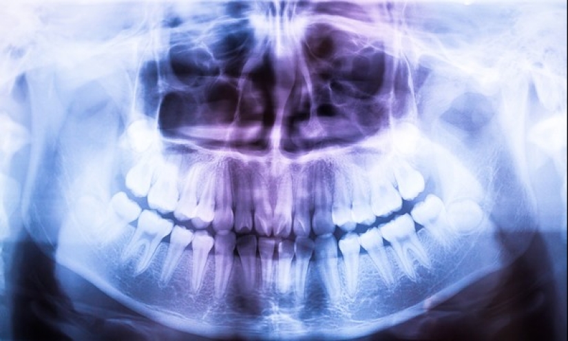 20 partes del cuerpo humano que son un ejemplo de mal diseño