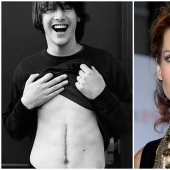 20 stories of the appearance of scars in Russian and foreign stars 20 stories of the appearance of scars in Russian and foreign stars