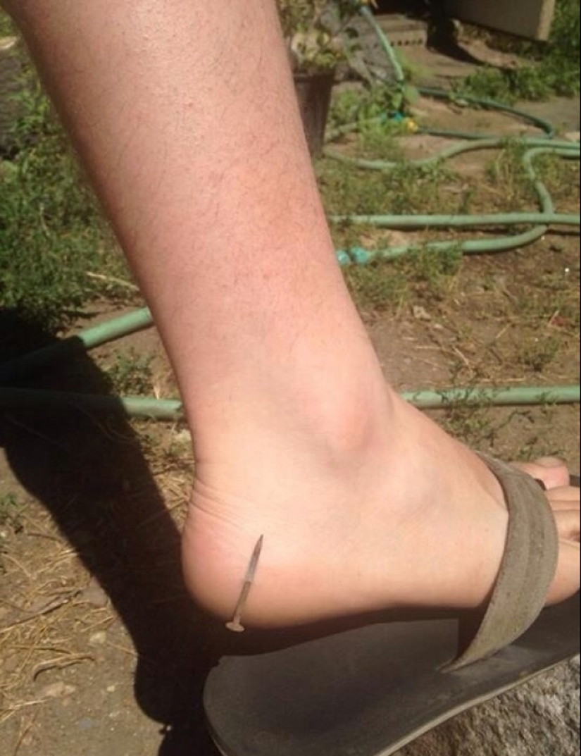 22 casos de suerte increíble