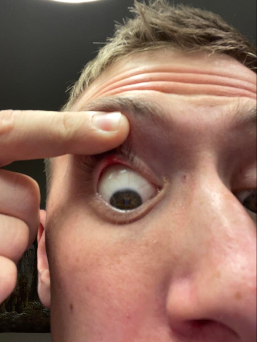 22 divertido, pero al mismo tiempo fotos tristes de personas que tuvieron mala suerte 22 divertido, pero al mismo tiempo fotos tristes de personas que tuvieron mala suerte