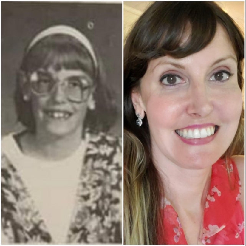 22 examples of how "ugly ducklings" became real handsome 22 examples of how "ugly ducklings" became real handsome