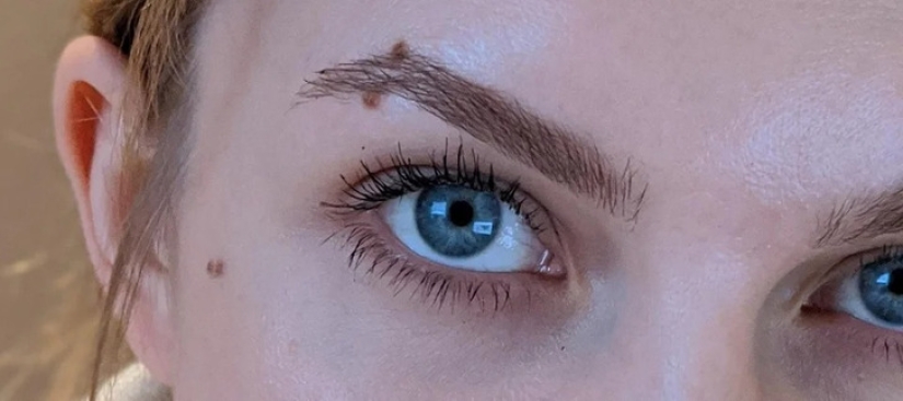 22 examples when a gene malfunction gave people a unique appearance chip 22 examples when a gene malfunction gave people a unique appearance chip