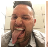 22 examples when a gene malfunction gave people a unique appearance chip 22 examples when a gene malfunction gave people a unique appearance chip