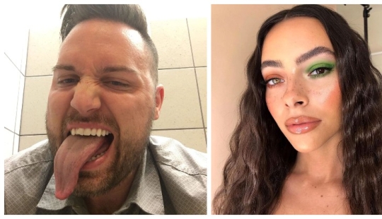 22 examples when a gene malfunction gave people a unique appearance chip