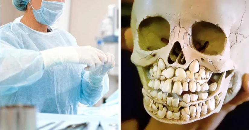 25 hechos extraños, espeluznantes y espeluznantes sobre el cuerpo humano 25 hechos extraños, espeluznantes y espeluznantes sobre el cuerpo humano